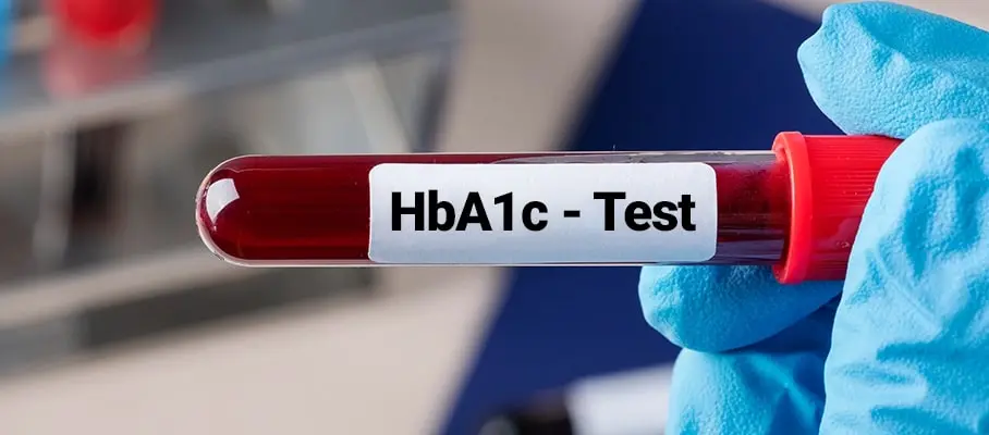 کیت بیوشیمی هموگلوبین hba1c چیست